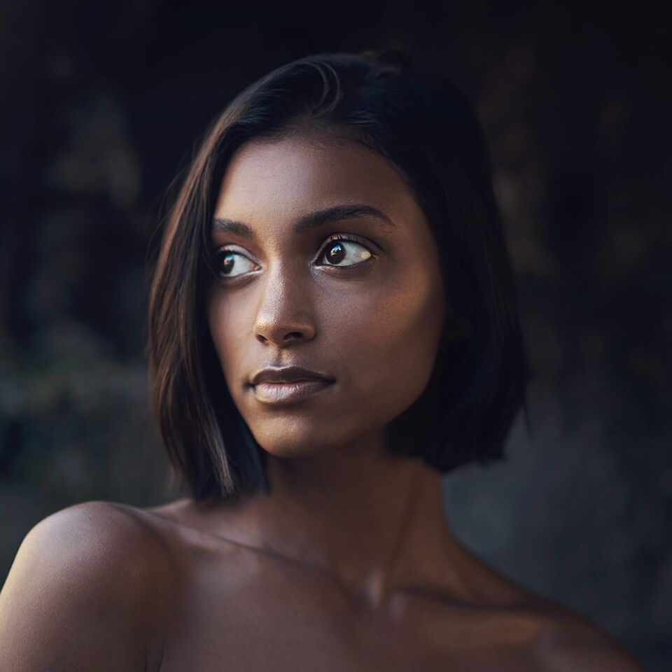 Dermal filler treatment