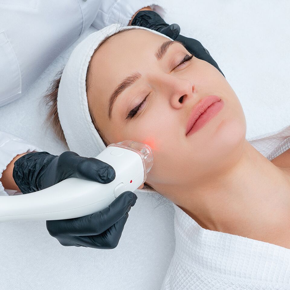 Erbium laser resurfacing