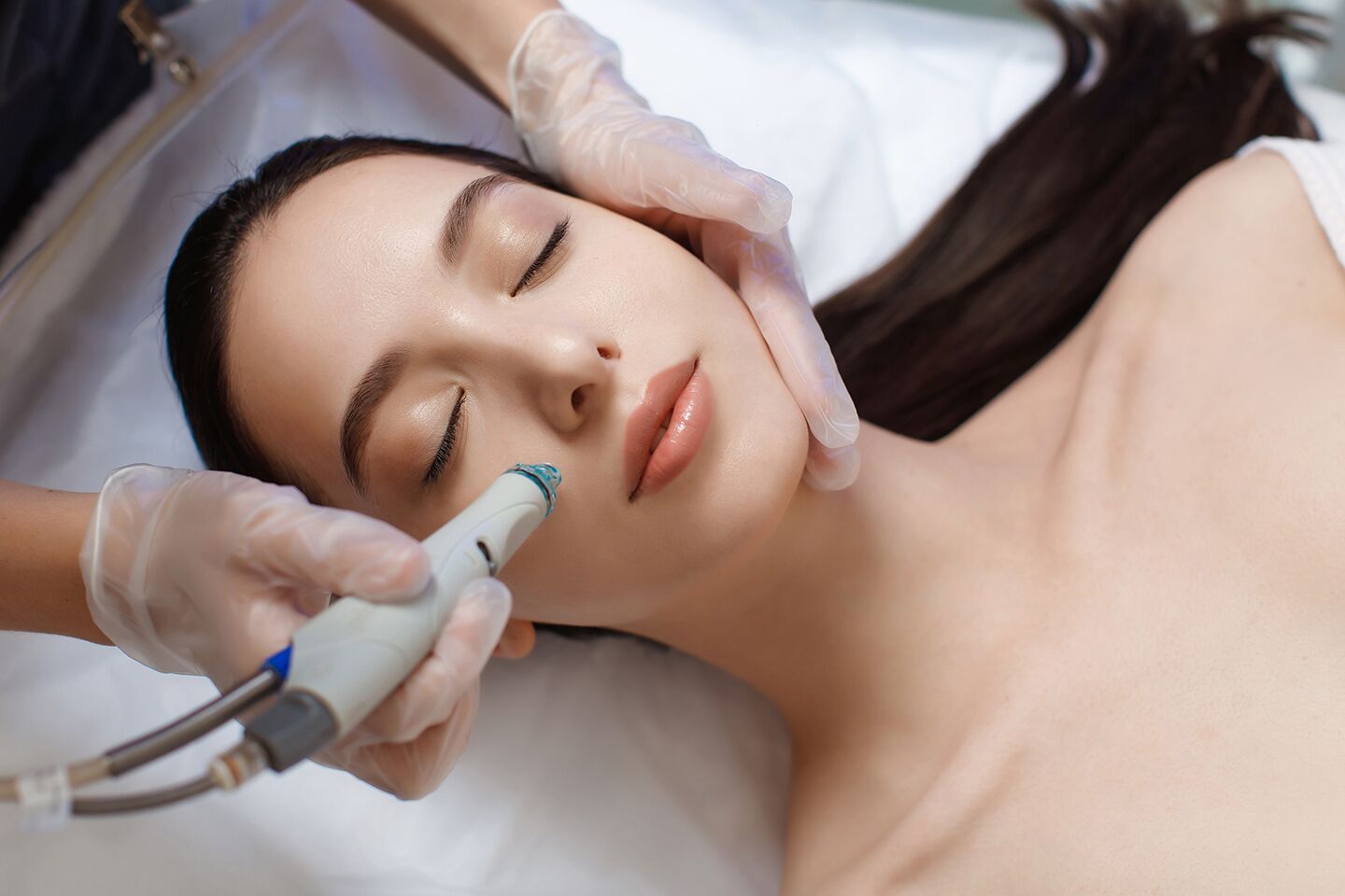 Erbium laser resurfacing