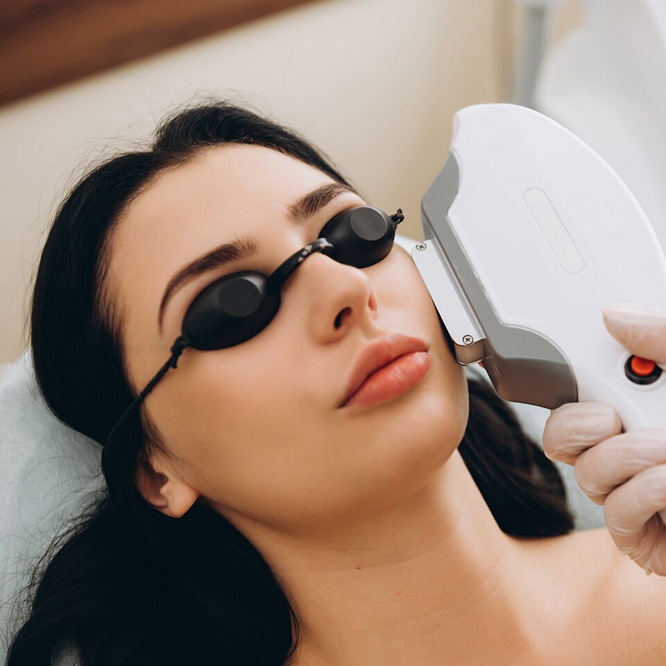 IPL skin treatment