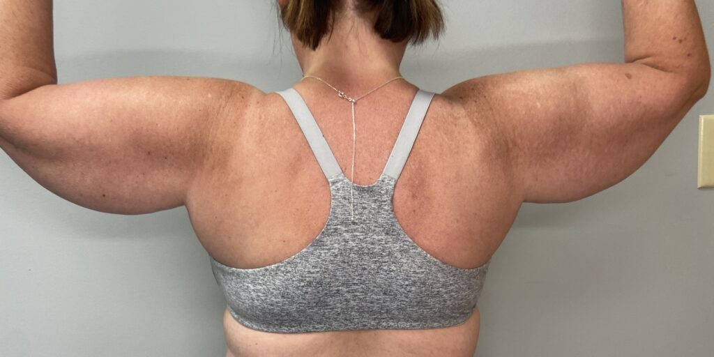 Before – Back View
